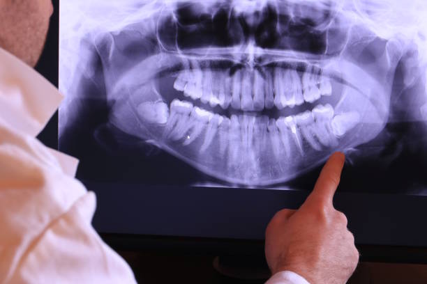 Best Weekend Emergency Dentist in Johns Creek, GA