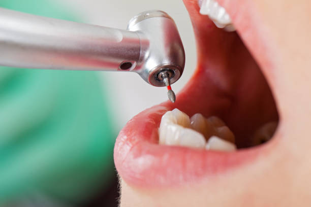 Best Mobile Emergency Dentist in Johns Creek, GA
